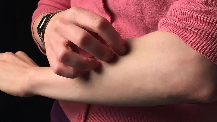 Žena češe podlakticu na kojoj se ne vidi osip